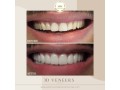 trusted-dental-clinic-in-dubai-small-4