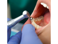 trusted-dental-clinic-in-dubai-small-1