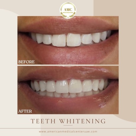 trusted-dental-clinic-in-dubai-big-8