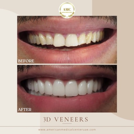 trusted-dental-clinic-in-dubai-big-4